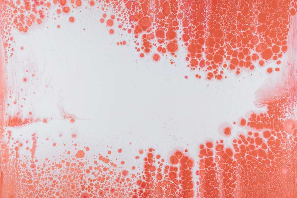 Managing Anemia during Pregnancy