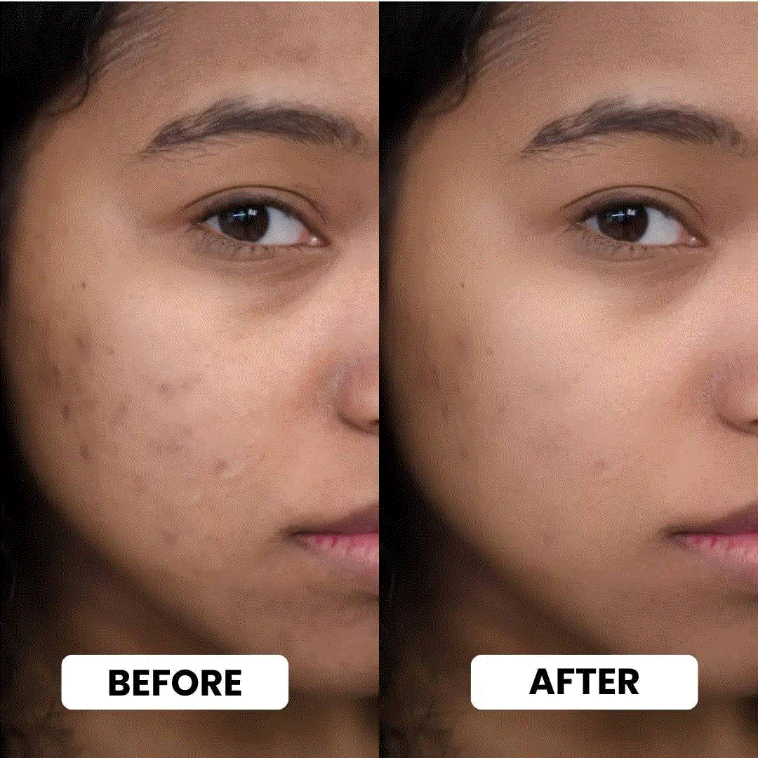 Radiance Ritual Bundle skincare results showing before-and-after close-ups of facial skin with a smoother, more even appearance